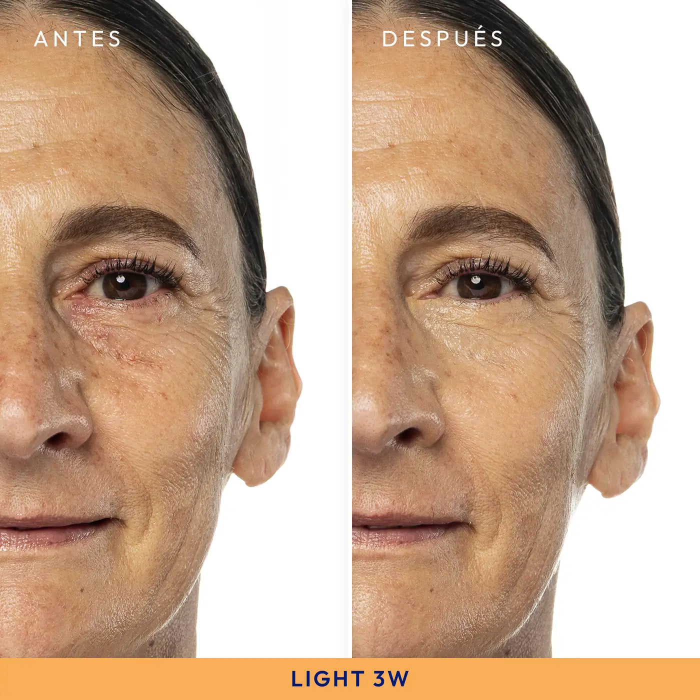 LIGHTS ON | CORRECTOR LIQUIDO